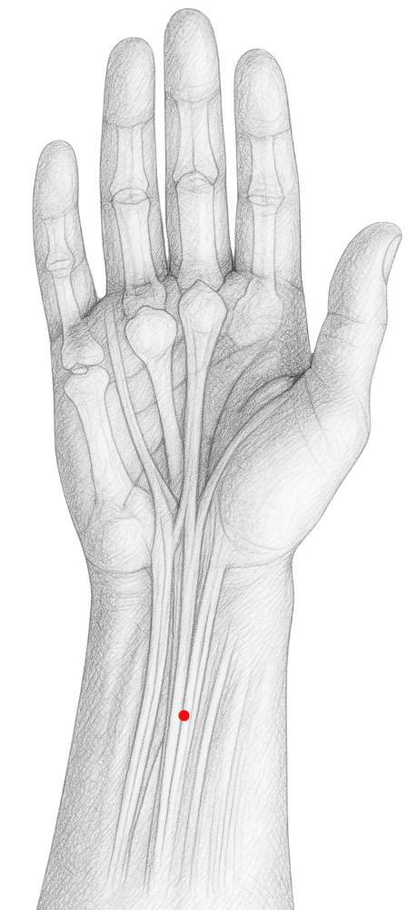 Perikard 6 Akupressurpunkt